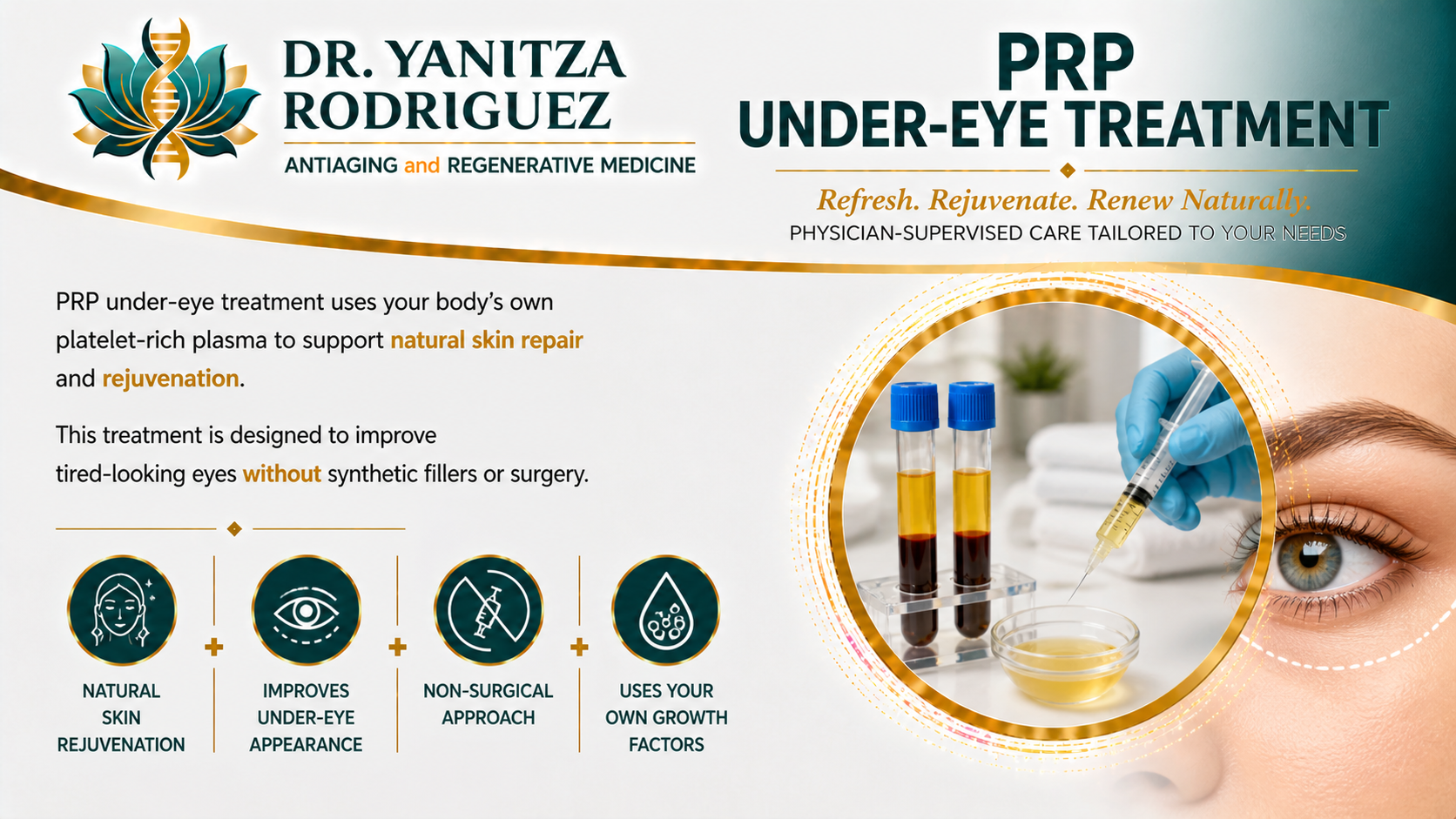 PRP under-eye treatment illustration